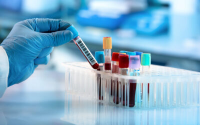 Improving Bioanalytical Flexibility and Efficiency with Whole Blood Cryopreservation
